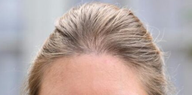 image question